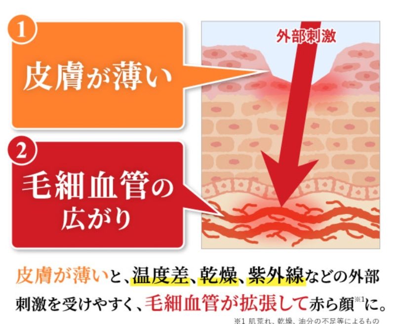 肌の断面図と赤み(炎症)のイメージ